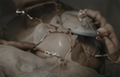 Reconstructive surgery