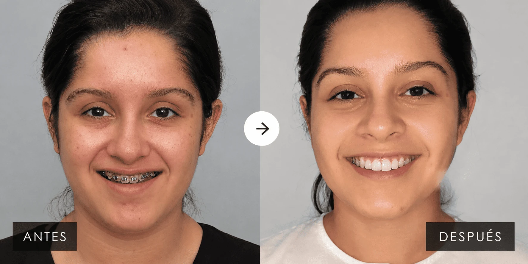 Orthognathic surgery